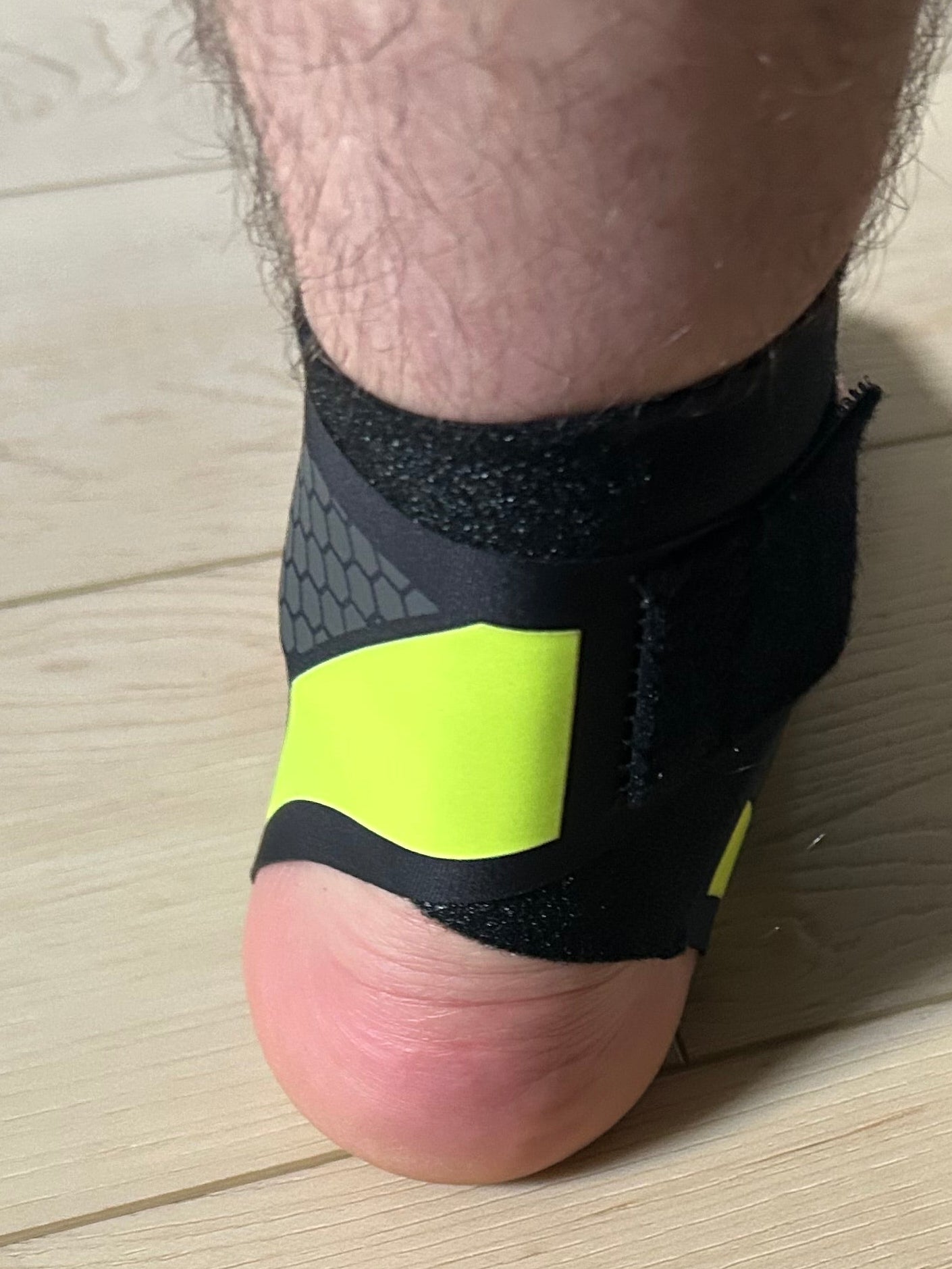 Ankle Support